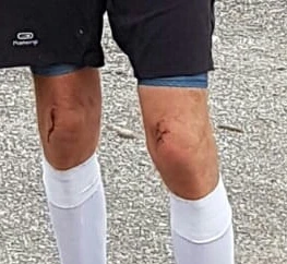 Keith Robins on his journey